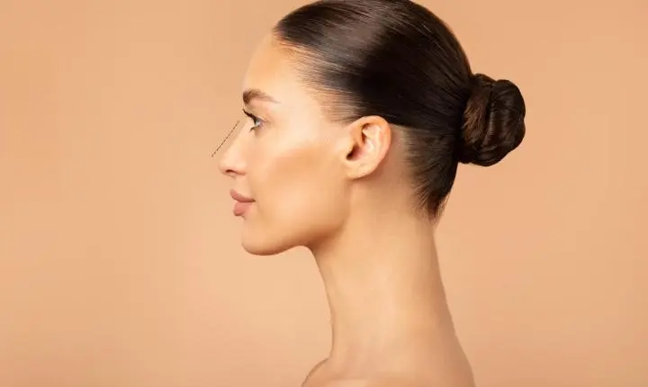 Avanços na rinoplastia aprimoram estética e função nasal