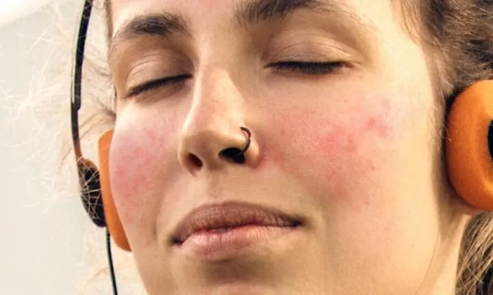 Pele sensível: especialista alerta para sinais e tratamentos